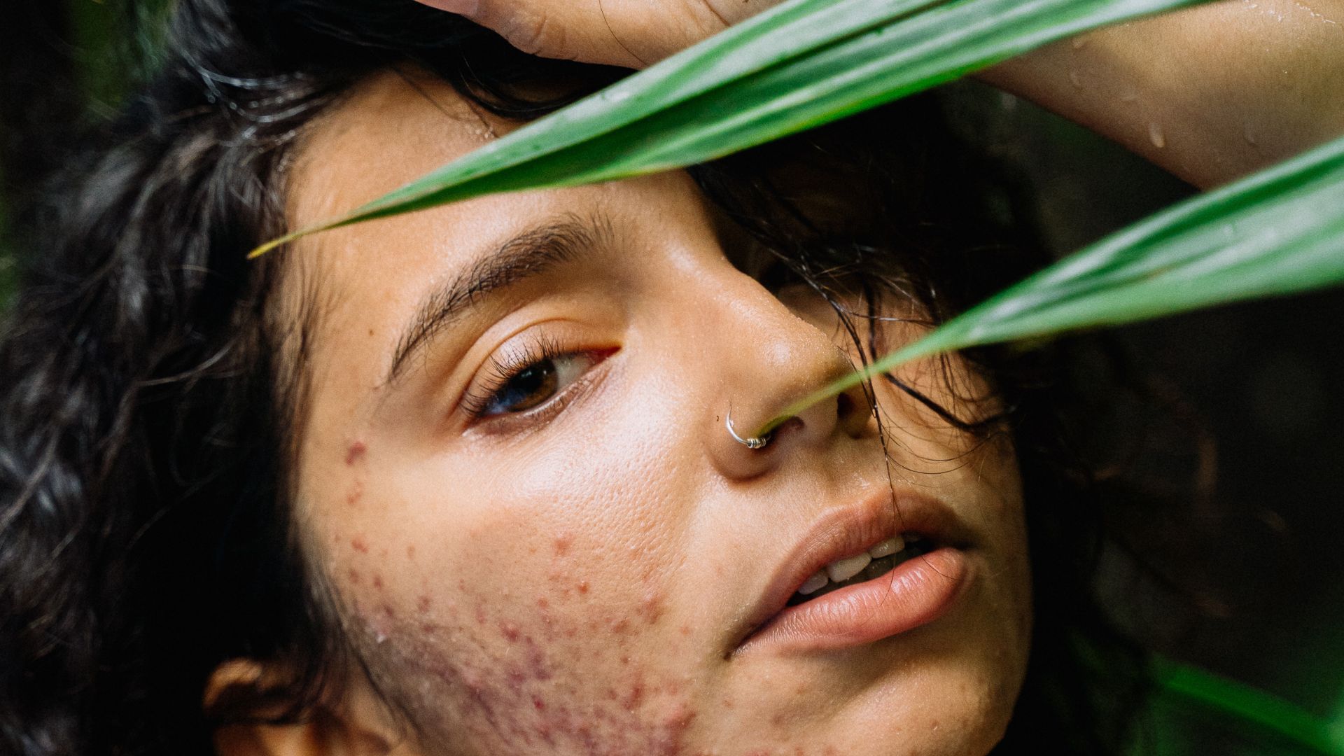 Routine skincare per uniformare la pelle dopo l'acne