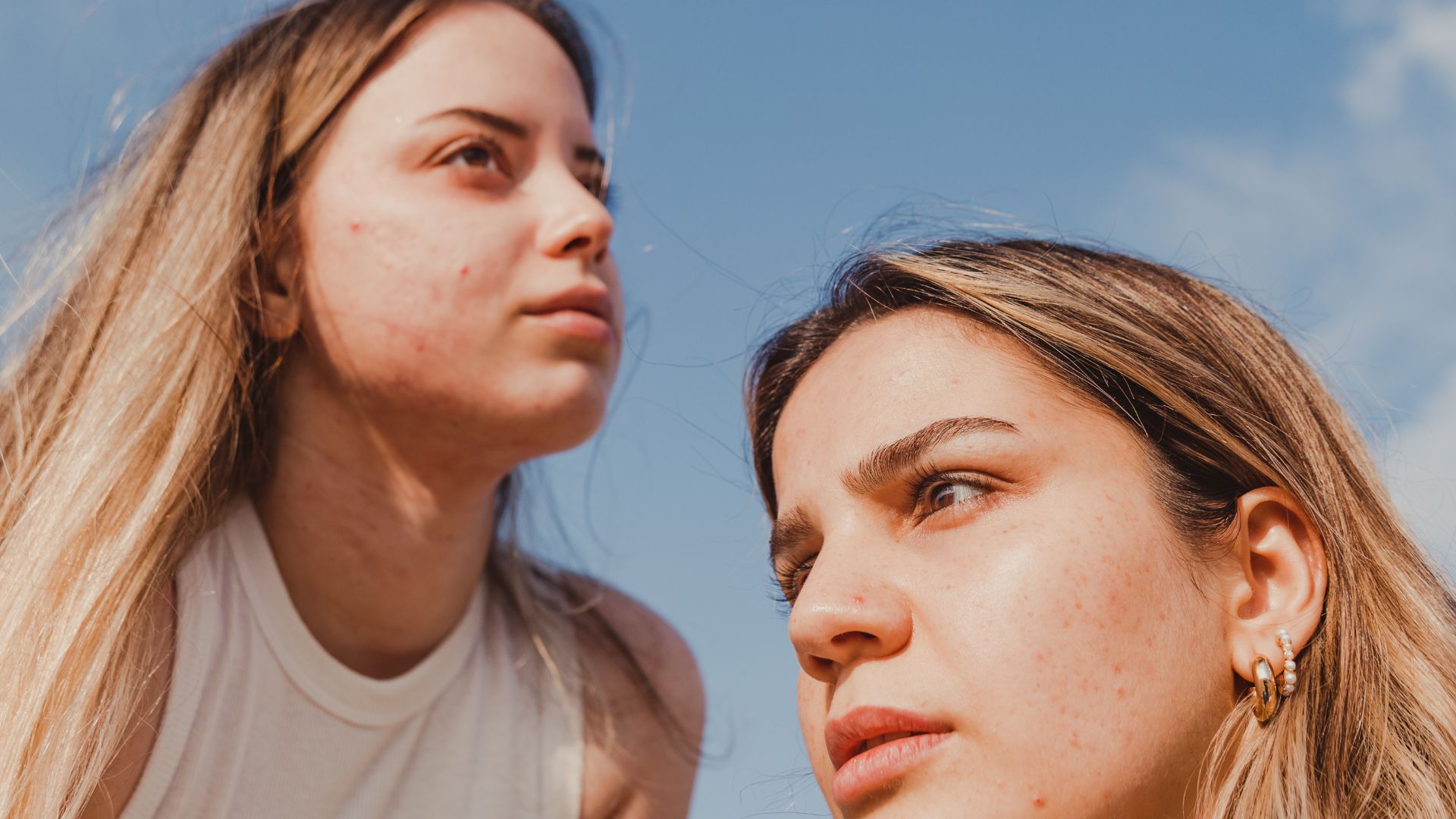 Prevenzione dei nuovi segni da acne