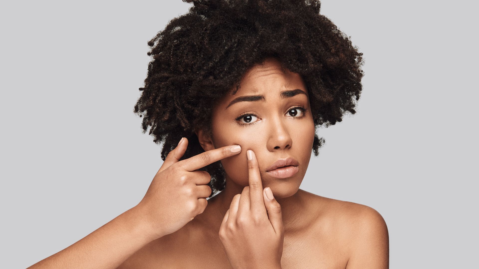 I pericoli dello schiacciare i brufoli: come trattare correttamente l'acne senza creare cicatrici