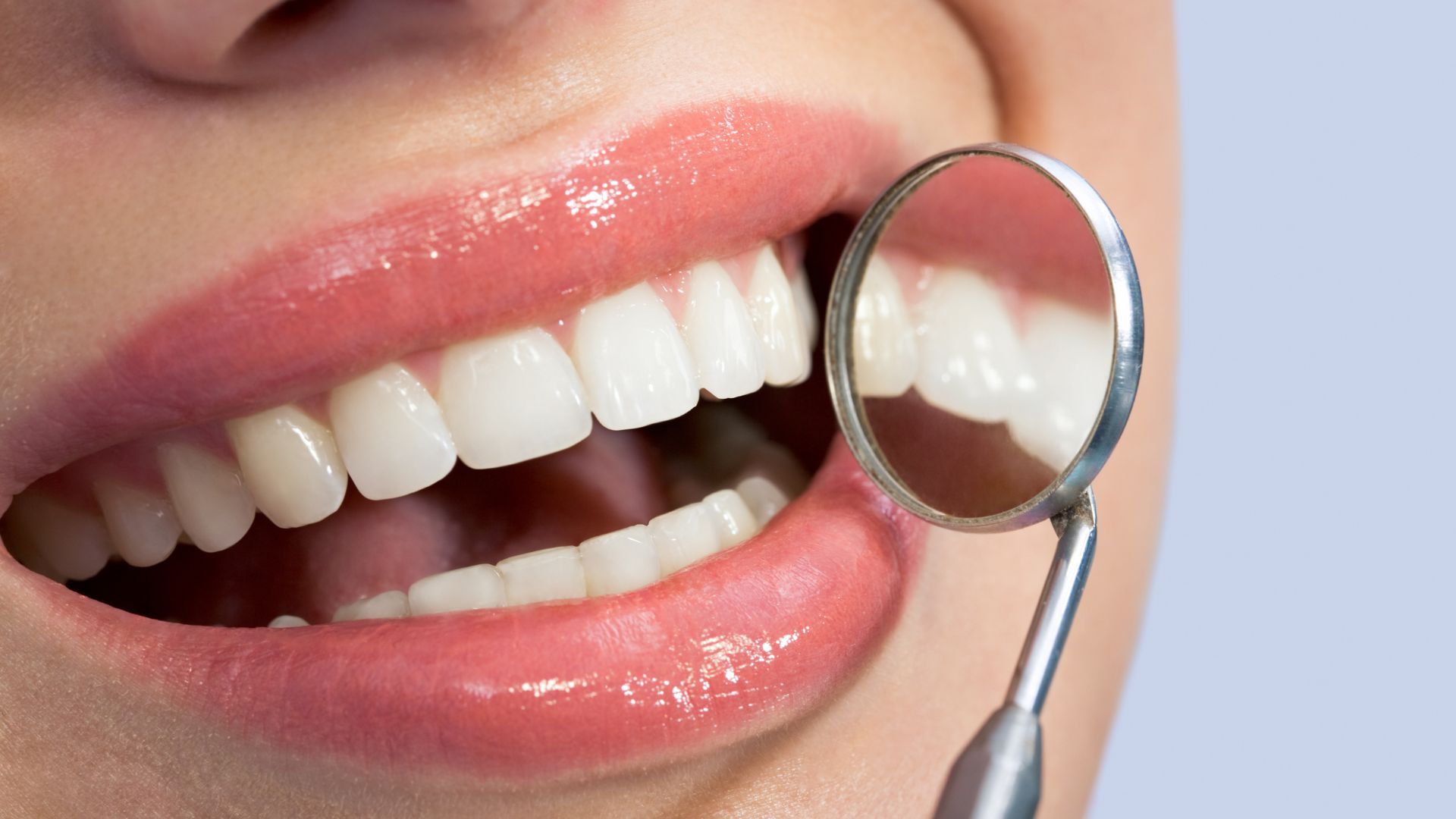 Denti bianchi con specchietto del dentista
